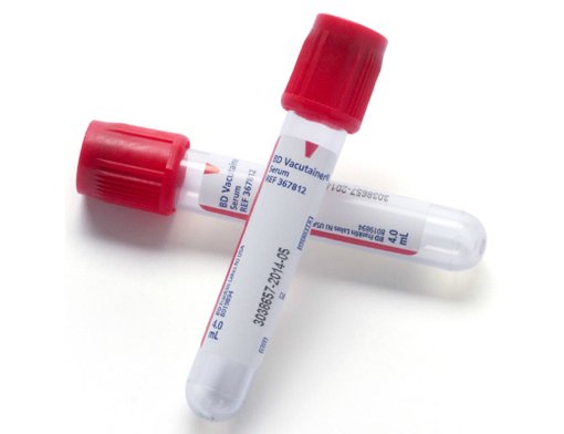 Ống nghiệm lấy máu thường nắp đơn Clot Activator 4ml